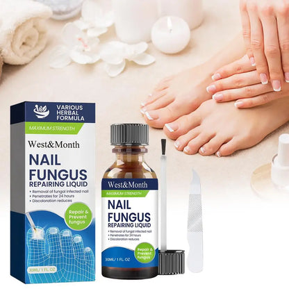 7 Days Nail Repair Serum Nail Fungal Removal Onychomycosis Paronychia Treatment Nail Softener Ingrown Essential Oil Toenail Care