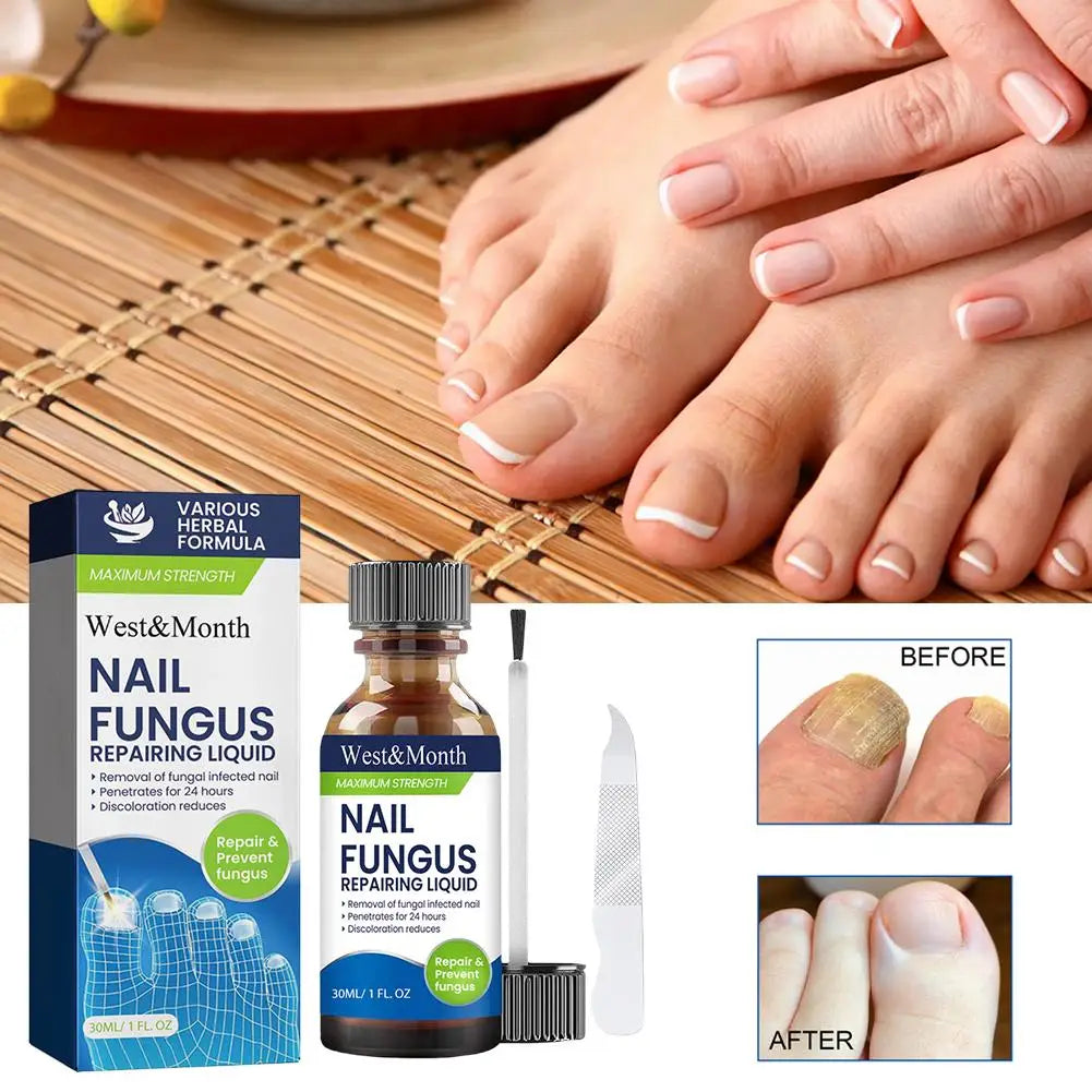 7 Days Nail Repair Serum Nail Fungal Removal Onychomycosis Paronychia Treatment Nail Softener Ingrown Essential Oil Toenail Care