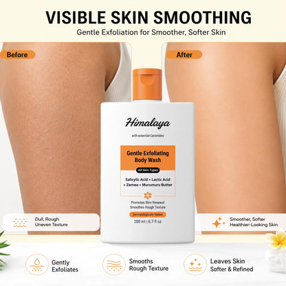 Private Label Salicylic Acid Body Wash for Keratosis Pilaris Deep Exfoliation Smooth Bumpy Uneven Skin Texture Shower Gel