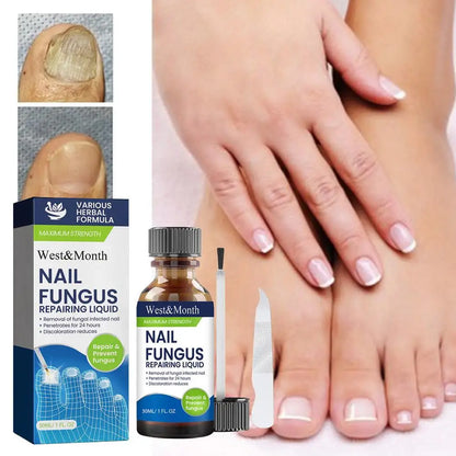 7 Days Nail Repair Serum Nail Fungal Removal Onychomycosis Paronychia Treatment Nail Softener Ingrown Essential Oil Toenail Care